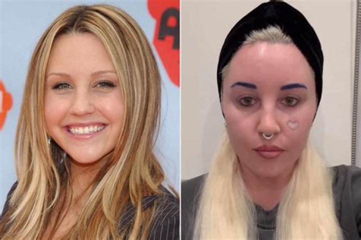 Amanda Bynes was involved in a hit-and-run in LA, but she wasn’t charged