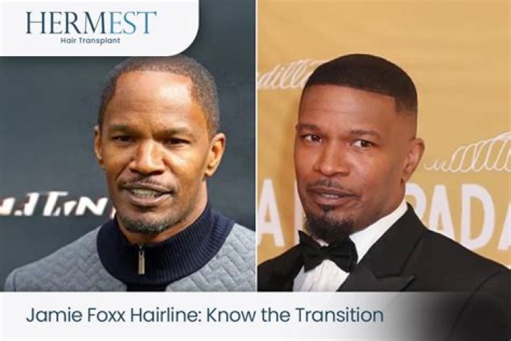 Fans Are Confused by the Constantly Moving Jamie Foxx Hairline