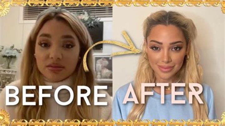 Gabby Amour Before And After Plastic Surgery – Age Height And Wikipedia