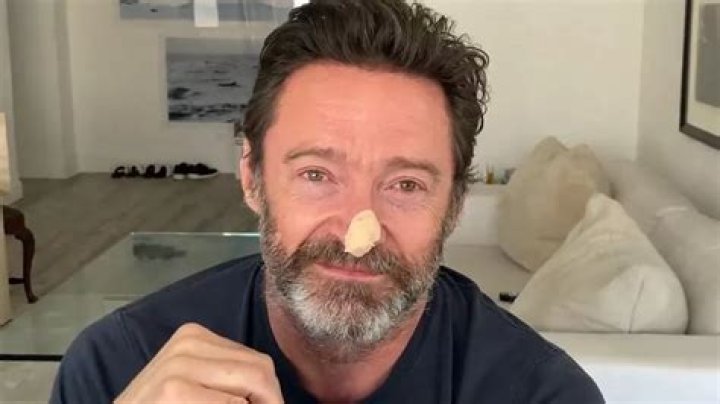 Hugh Jackman Urges Fans to Use Sunscreen after Second Skin Cancer Procedure