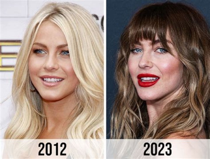Julianne Hough Face No Makeup Photos Cosmetic Surgery Before And After