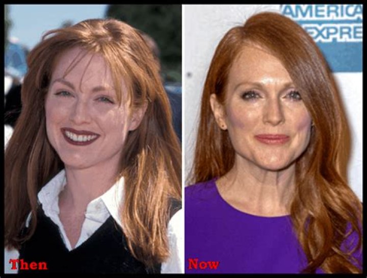 Julianne Moore on plastic surgery: “It just looks weird, there’s something off”