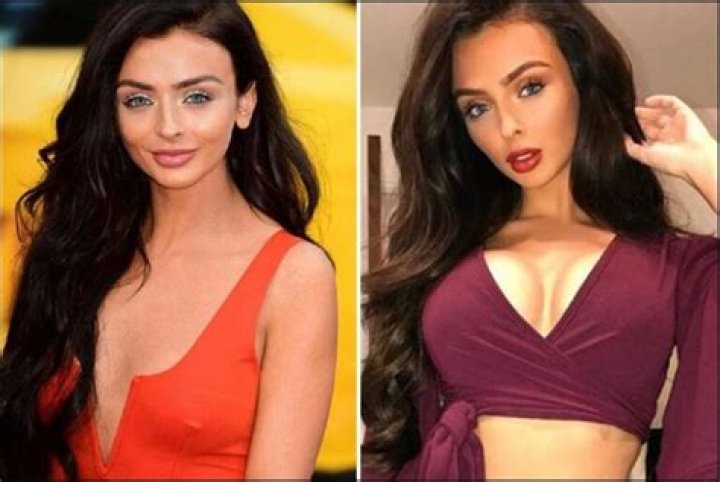 Kady Mcdermott Surgery: Did She Get Boobs Job Done? Before And After Pics