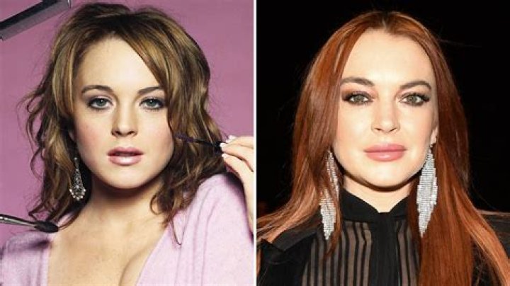 Lindsay Lohan slams Ashlee Simpson for getting plastic surgery