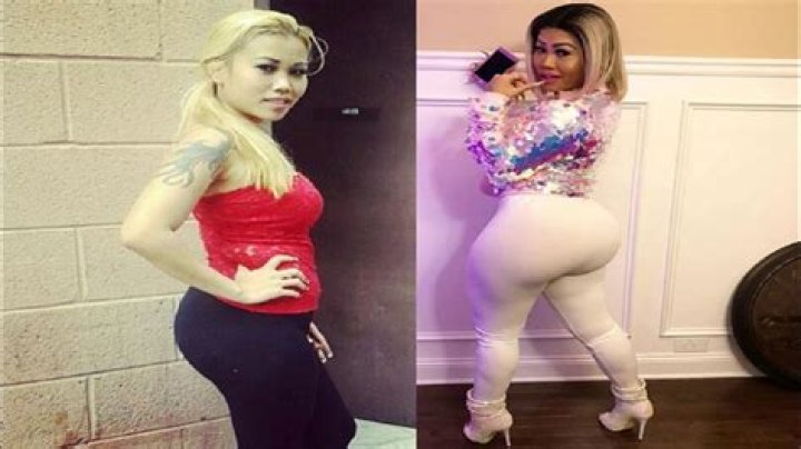 Lovely Mimi Before Surgery Pics, Real Name Age And Wikipedia Bio