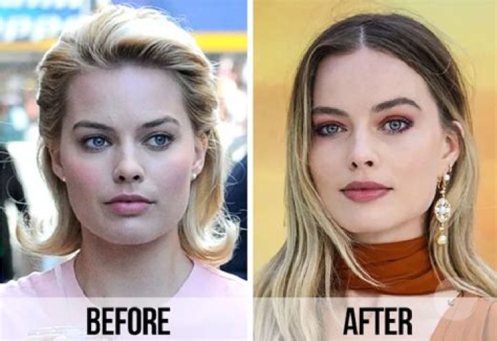 Margot Robbie Nose Job: Before And After Photos Fans Suspect Lip Filler