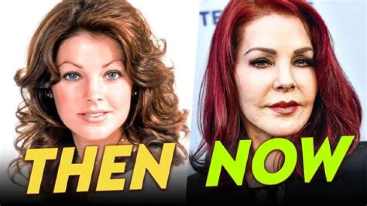 Priscilla Presley’s surgeon needs to take one giant step back