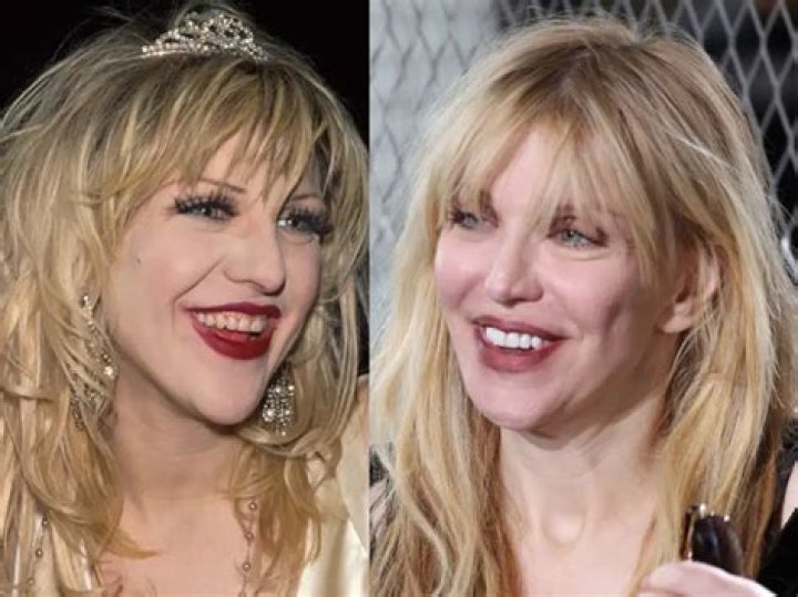 What’s wrong with Courtney Love’s teeth?!